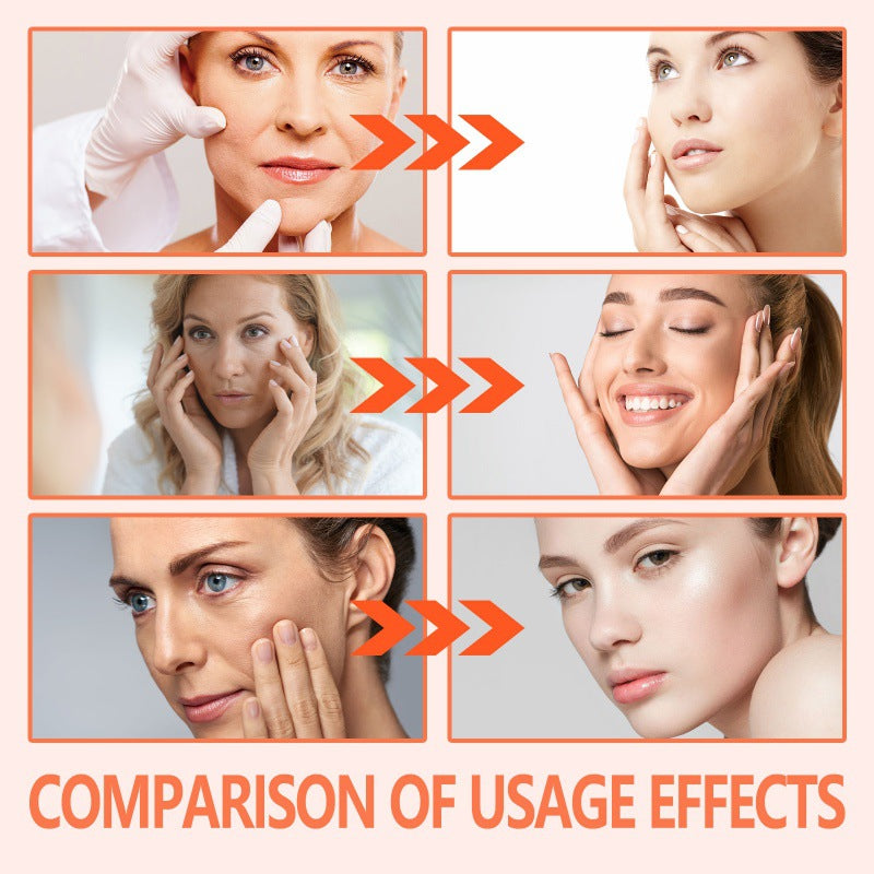 Rose Oil Smoothen Fine Wrinkles Skin Care
